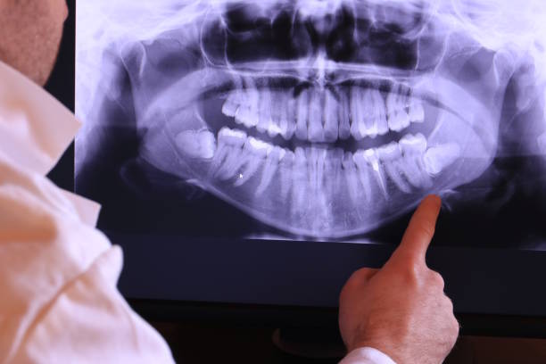 Best Emergency TMJ Treatment in Anahola, HI